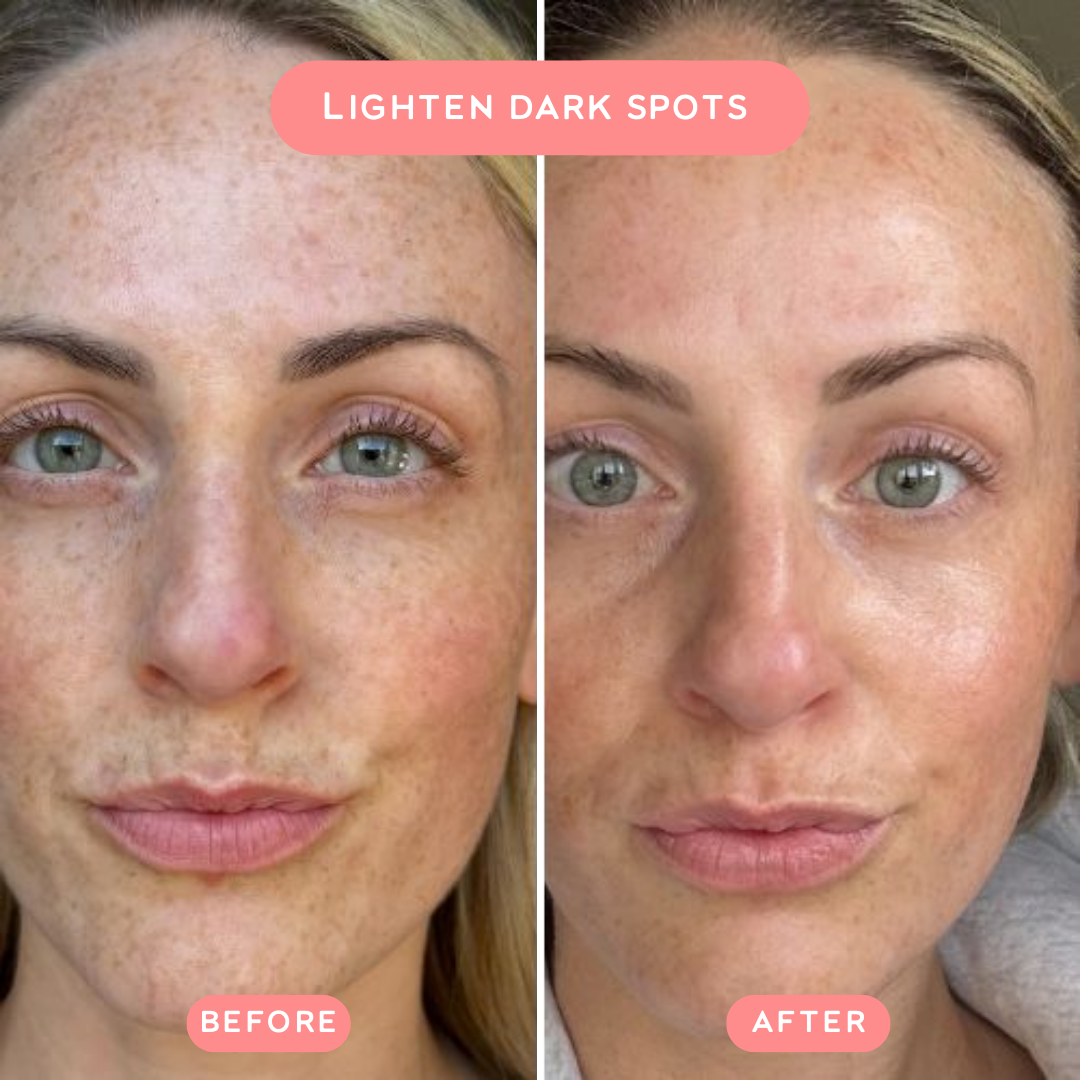 ReGlow™ Red Light Wrinkle Wand